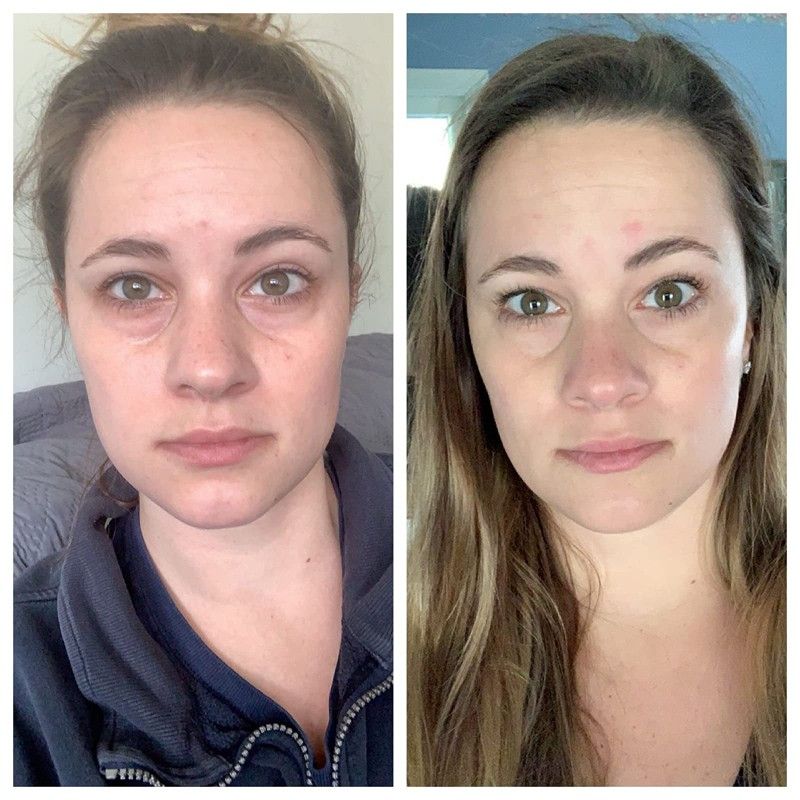 The Transformation